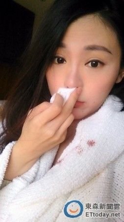 �_��Ů�����ھ����m��(y��ng)�������Ѫ�۽z���۫IӋ