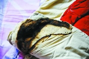 �m��һ�������18��l(f��)��13����ȼ ԭ����(�D)