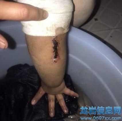 ��Ůͯһֻ�ֱ������L(zh��ng)�l�΂��� �DƬ��(l��i)Դ�����L(f��ng)�߹��D