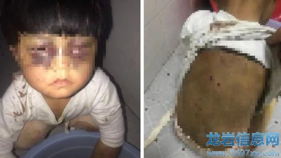 ��Ůͯ���ϬF(xi��n)��̎���� �DƬ��(l��i)Դ�����L(f��ng)�߹��D